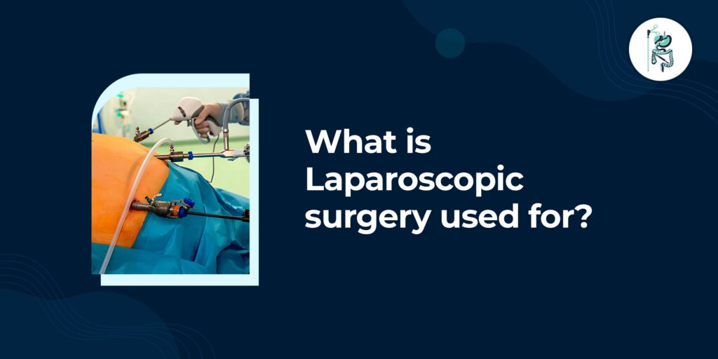 What is laparoscopic surgery?